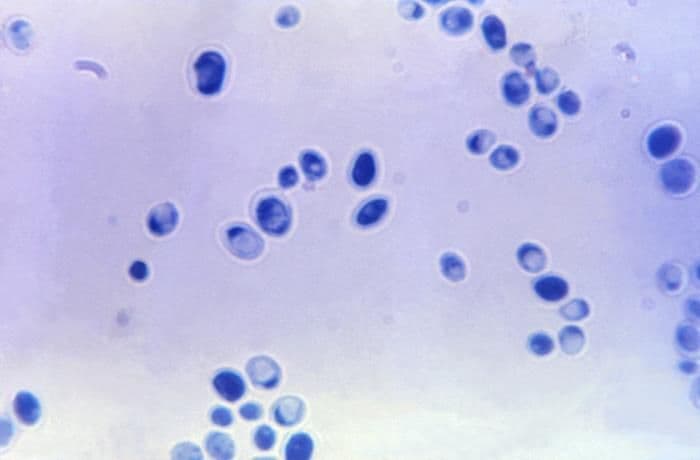 The microscopic image of Candida fungus.